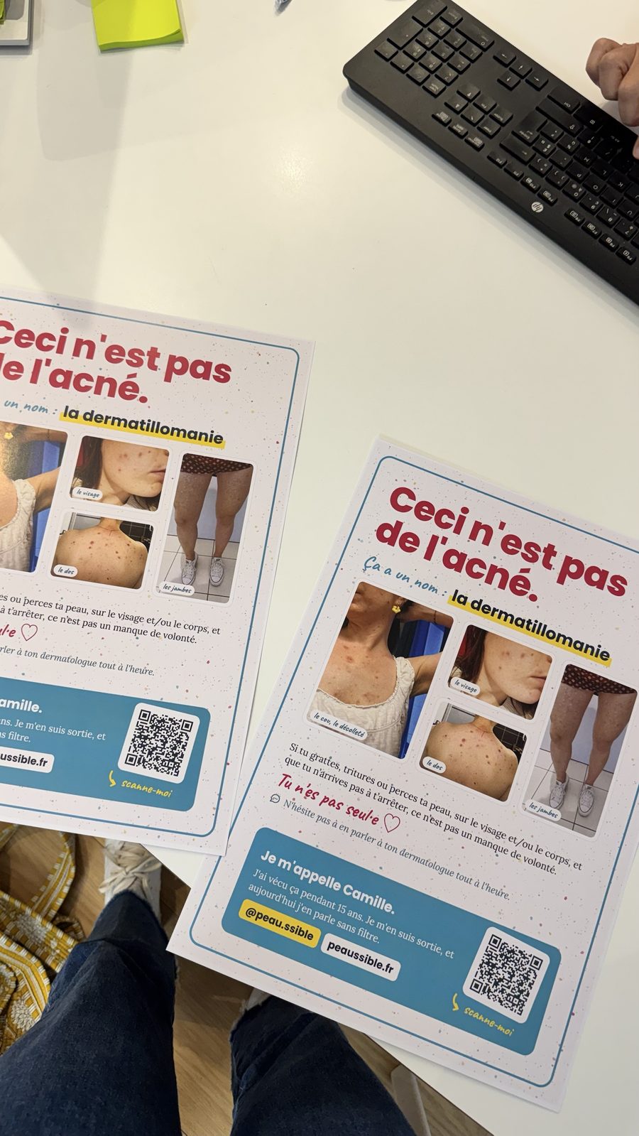 Les nouvelles affiches sur la dermatillomanie, posées sur le bureau de la dermatologue